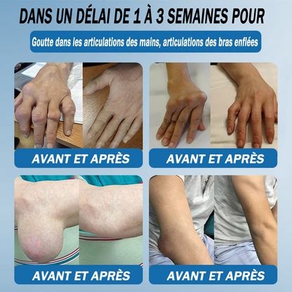 Natravor® 𝐁𝐏𝐂-𝟏𝟓𝟕 𝐉𝐨𝐢𝐧𝐭 𝐇𝐞𝐚𝐥𝐢𝐧𝐠 𝐂𝐫𝐞𝐚𝐦🦴Treats Arthritis, Neuropathy, Rheumatism, Sports Injuries & More🏆