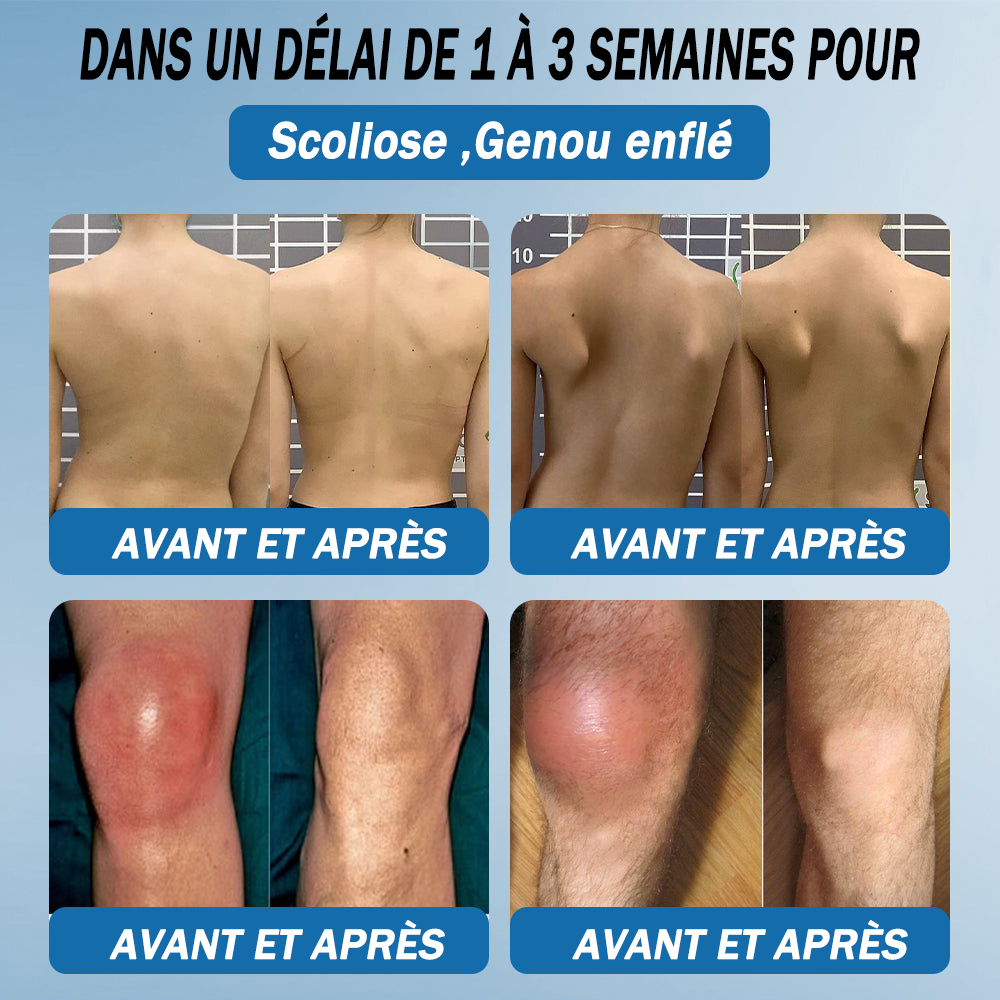 Natravor® 𝐁𝐏𝐂-𝟏𝟓𝟕 𝐉𝐨𝐢𝐧𝐭 𝐇𝐞𝐚𝐥𝐢𝐧𝐠 𝐂𝐫𝐞𝐚𝐦🦴Treats Arthritis, Neuropathy, Rheumatism, Sports Injuries & More🏆