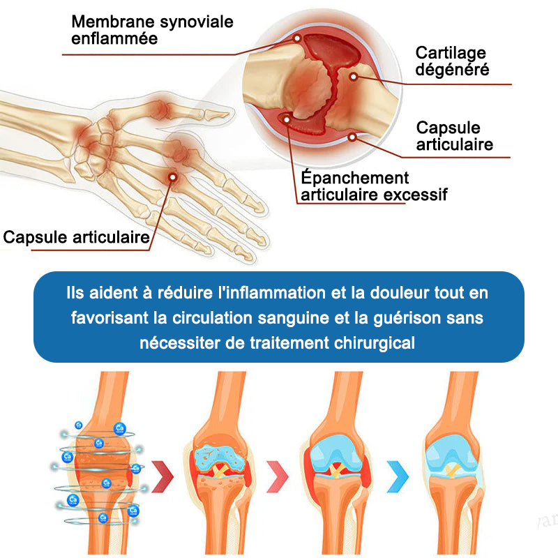 Natravor® 𝐁𝐏𝐂-𝟏𝟓𝟕 𝐉𝐨𝐢𝐧𝐭 𝐇𝐞𝐚𝐥𝐢𝐧𝐠 𝐂𝐫𝐞𝐚𝐦🦴Treats Arthritis, Neuropathy, Rheumatism, Sports Injuries & More🏆