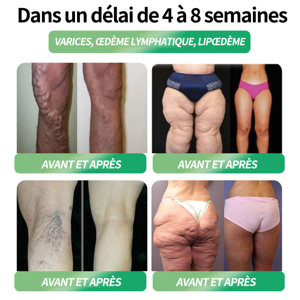 Boutique ANSM : 𝐍𝐚𝐭𝐫𝐚𝐯𝐨𝐫® NAD 6-en-1 (1 dose/jour, résultats visibles en 7 jours) 👨‍⚕️ Pour obésité, cœur, diabète, sommeil, digestion, articulations et plus
