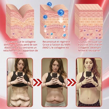 Fabriqué en France 🎇 𝗡𝗮𝘁𝗿𝗮𝘃𝗼𝗿® 𝗡𝗠𝗡 𝗡𝗔𝗗+ Solution orale raffermissante & anti-âge