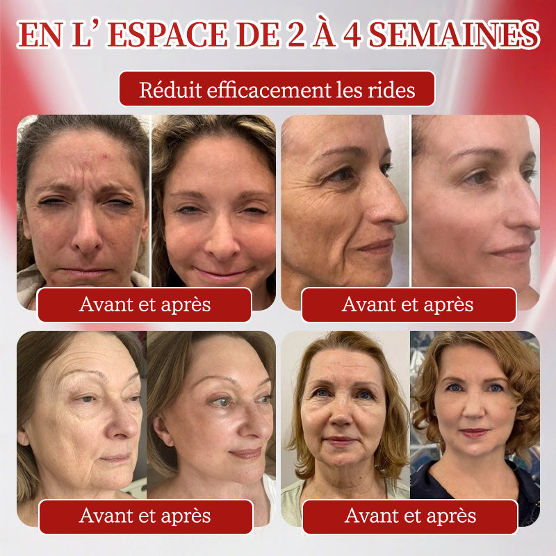 Fabriqué en France 🎇 𝗡𝗮𝘁𝗿𝗮𝘃𝗼𝗿® 𝗡𝗠𝗡 𝗡𝗔𝗗+ Solution orale raffermissante & anti-âge
