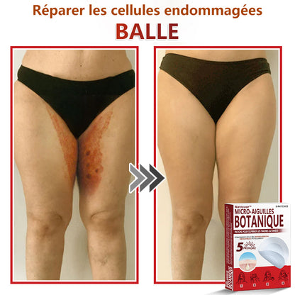 Patchs botaniques à micro-aiguilles Natravor® pour l'élimination des acrochordons ✅Fabriqué en France